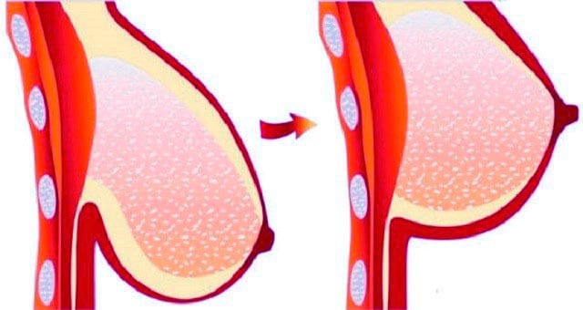 Diagram illustrating the product's effect on firmness and structure.
